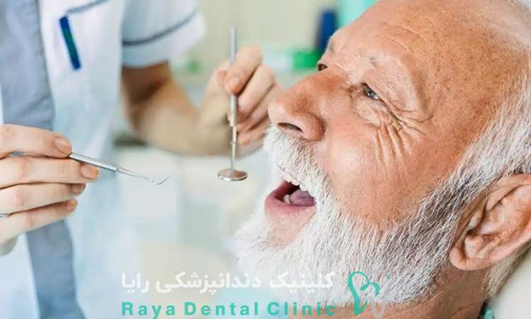 محدودیت سنی کاشت ایمپلنت