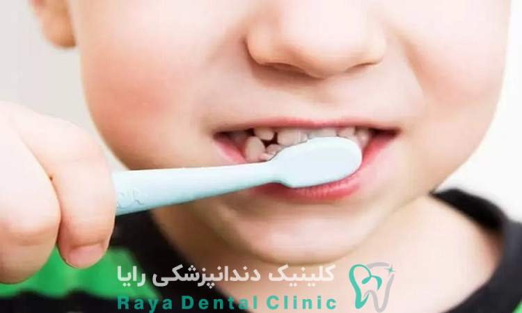 انتخاب مسواک و خمیر دندان