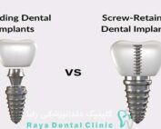 ایمپلنت دندان جلویی