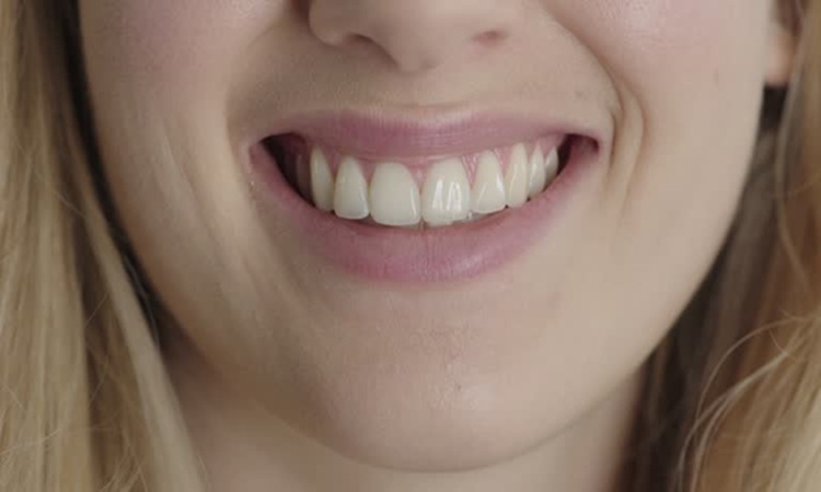 طراحی لبخند در اصلاح آن