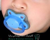 مکیدن پستانک به دندان