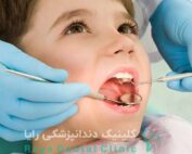 پیامد افتادن دندان شیری