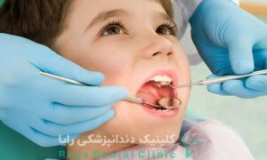 پیامد افتادن دندان شیری