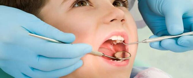 پیامد افتادن دندان شیری