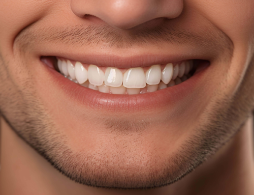 چرا بعضی لبخندها حتی با دندان سالم هم جذاب نیستند؟