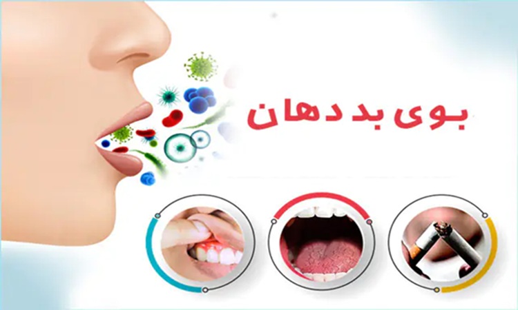 علت بوی بد دهان