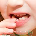 علت لق شدن دندان
