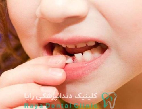 علت لق شدن دندان در بزرگسالان چیست؟