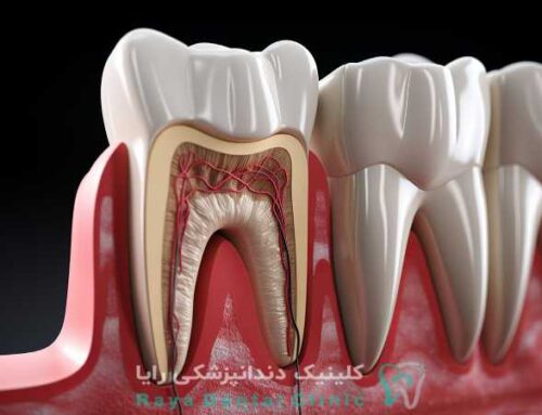 علائم هشدار دهنده دندان در آستانه عصب کشی