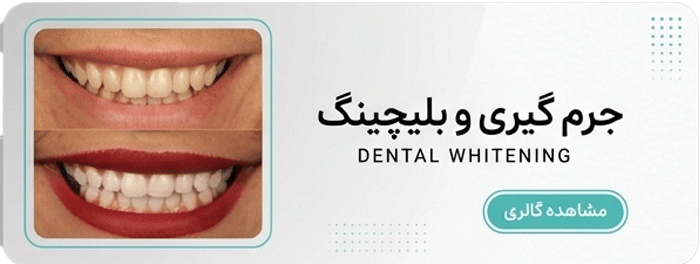 بلیچینگ و جرم گیری