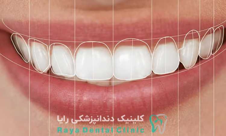 نقش طرح لبخند بر صورت