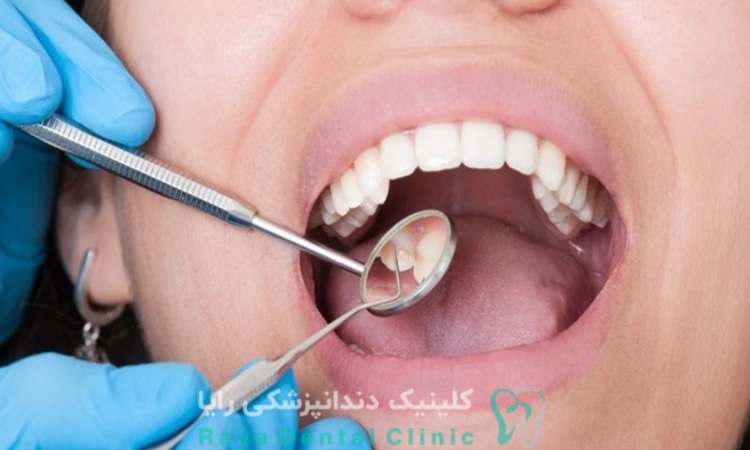 خرابی یا آسیب ایمپلنت