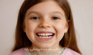هیپومینرالیزاسیون دندان