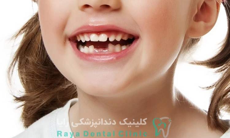 روش تشخیص هیپومینرالیزاسیون