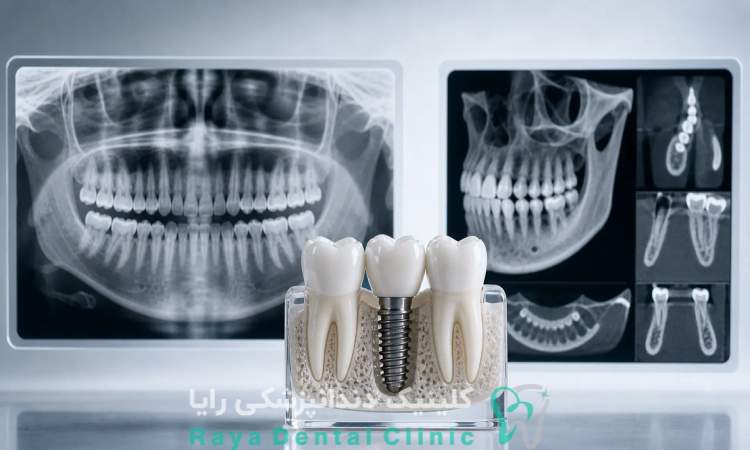 تصویر استخوان فک با CBCT