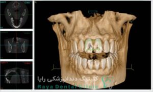 نقش عکس CBCT