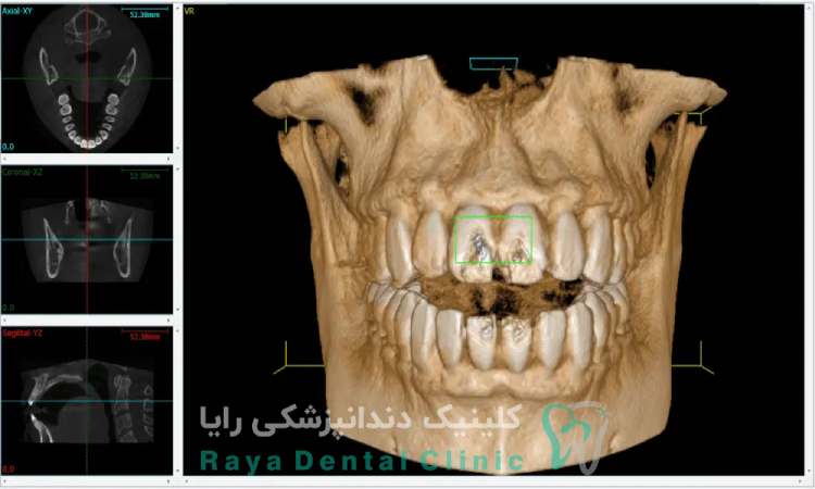 نقش عکس CBCT